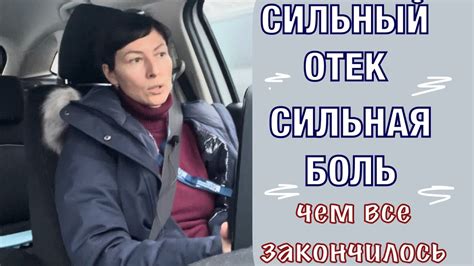 Отек и сильная боль