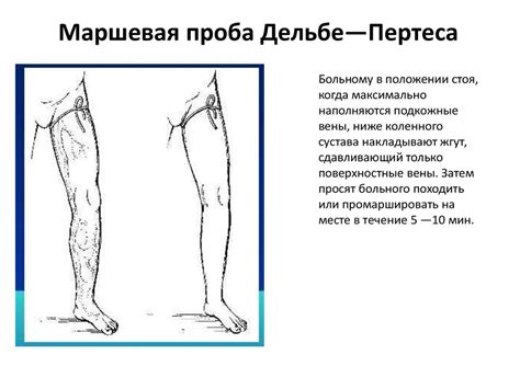 Отличительные особенности и значение положительной пробы Гаккенбруха