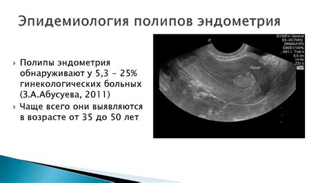 Отражение от эндометрия среднее