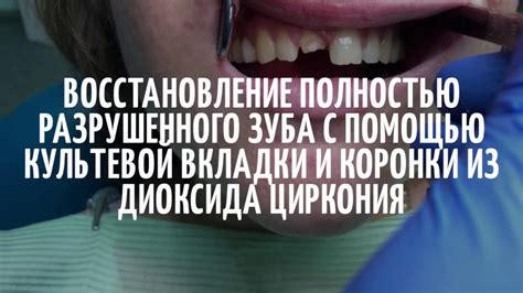 Отрицательные аспекты появления разрушенного зуба во сне и пути их преодоления