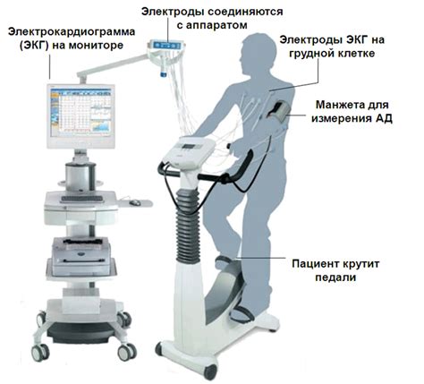 Отрицательный тест экг с нагрузкой и его значение