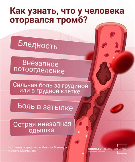 Отрыв тромба: почему это опасно и как происходит?