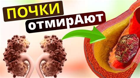 Очевидные и скрытые причины