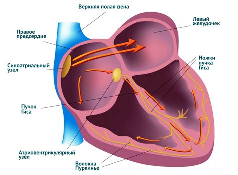 ПНПГ и нарушение внутрижелудочковой проводимости сердца