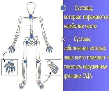 Паравертебральные мягкие ткани: их значение и влияние на здоровье