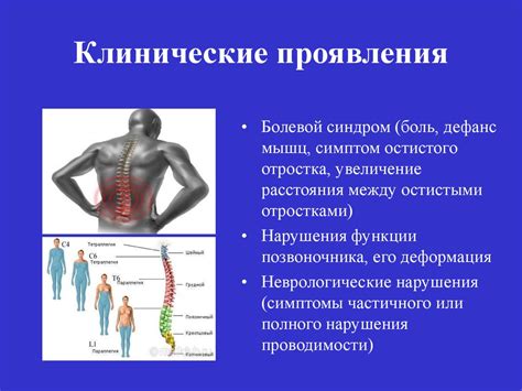 Патологии позвоночника и спинного мозга