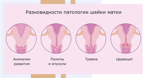 Патологии шейки матки