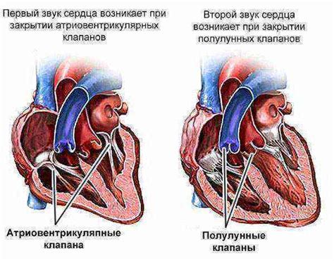 Патологические причины шума сердца