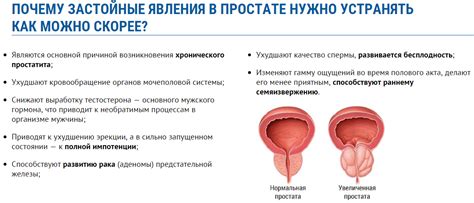 Патологические процессы в предстательной железе