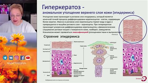 Патология плоского эпителия: причины возникновения