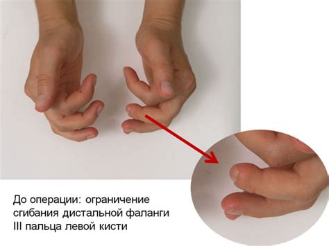 Первая часть: Причины отрубленного пальца