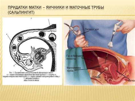 Перевязанные трубы у женщин