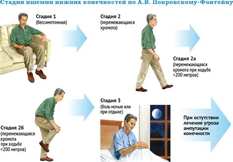 Периодическое похолодание конечностей