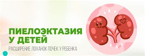 Пиелоэктазия: что это такое?