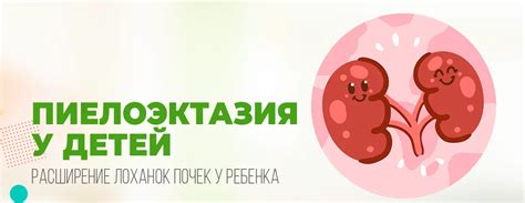 Пиелоэктазия у новорожденных