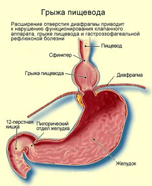 Пищевод и диафрагма