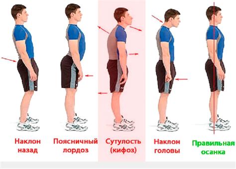 Плохая осанка и манеры