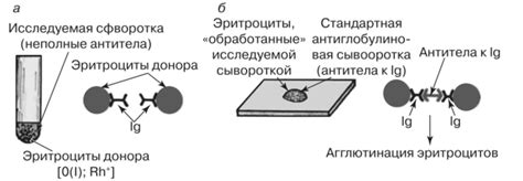 Плюсы и минусы метода непрямой пробы Кумбса