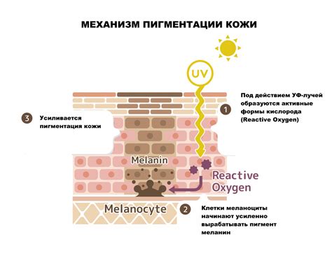 Повышенная меланиновая пигментация