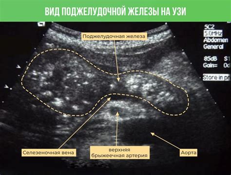 Повышенная эхогенность: что это значит?