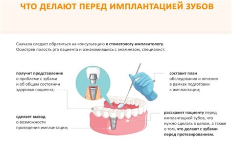 Подготовка к фиксированному протезированию