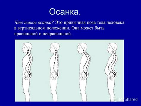 Поддержка правильной позы при вертикальном положении Эос