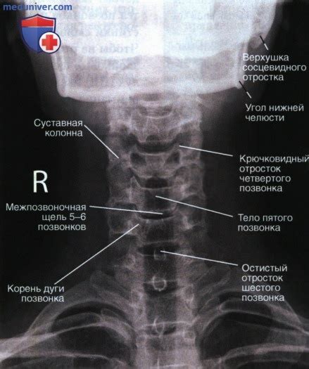 Поддержка шейных позвонков