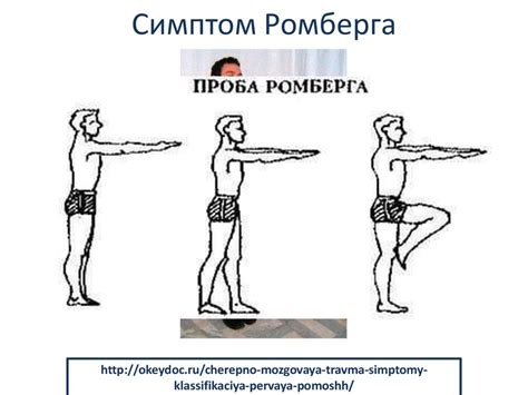 Поза Ромберга: суть и значение для устойчивости