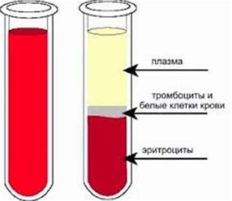 Показания для переливания плазмы