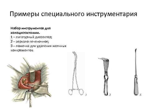 Показания для проведения холецистэктомии