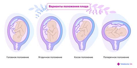 Положение ребенка в жаркой комнате