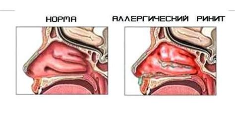 Положительный результат: причины и симптомы