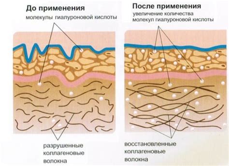 Положительный эффект никотинамида на состояние кожи