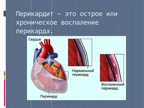 Полость перикарда: патологии и возможные проблемы