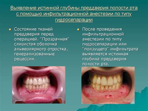 Помощь при запальных процессах в полости рта