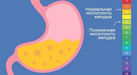 Пониженная кислотность желудка