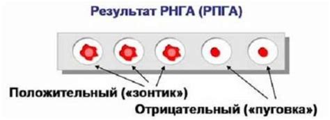 Понятие РПГА 4 и его истоки