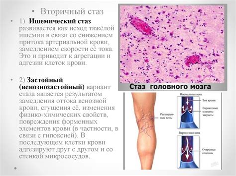 Понятие и причины развития