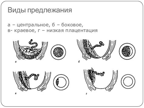 Понятие плаценты 3 сосуда