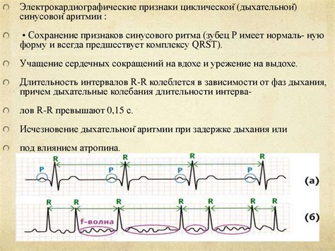 Понятие синусовой аритмии