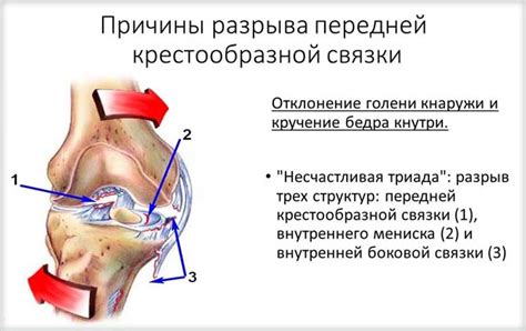 Понятие тотального разрыва связки