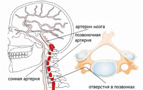 Поражение позвоночных артерий: причины и факторы риска