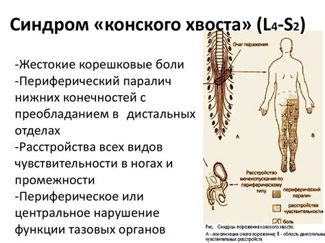 Поражение спинного мозга: что это такое?