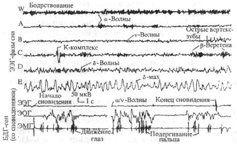 Пора погрузиться в глубины вторичного сновидения