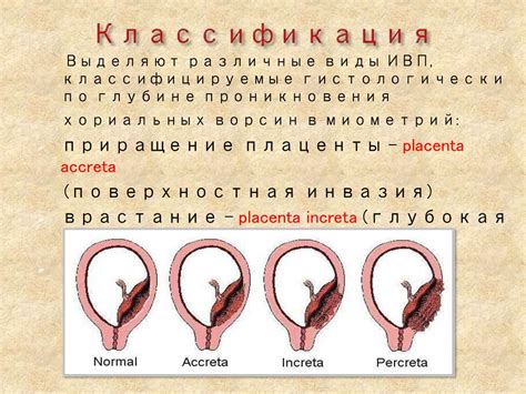 Последствия врастания плаценты