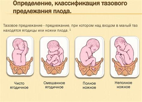 Последствия головного предлежания плода 1 позиции