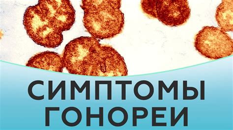 Последствия гонореи