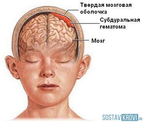 Последствия нарушений в функционировании мозга