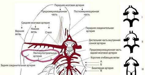 Последствия незамкнутого виллизиева круга