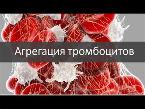 Последствия низкой агрегации тромбоцитов